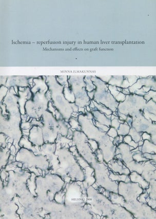 Item #2849 Ischemia : Reperfusion Injury in Human Liver Transplantation : Mechanisms and Effects...