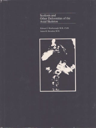 Item #3549 Scoliosis and Other Deformities of the Axial Skeleton. Edward J. Riseborough