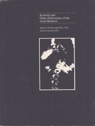Item #3549 Scoliosis and Other Deformities of the Axial Skeleton. Edward J. Riseborough